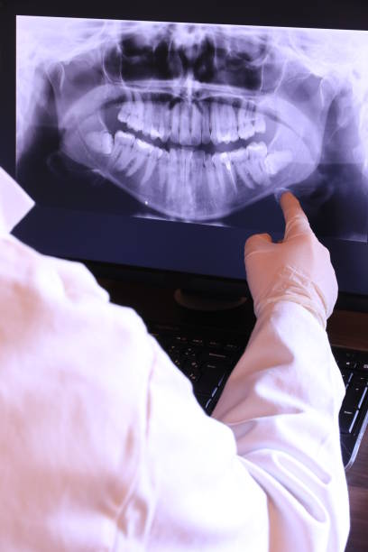 Best Emergency Gum Treatment in Monterey, TN